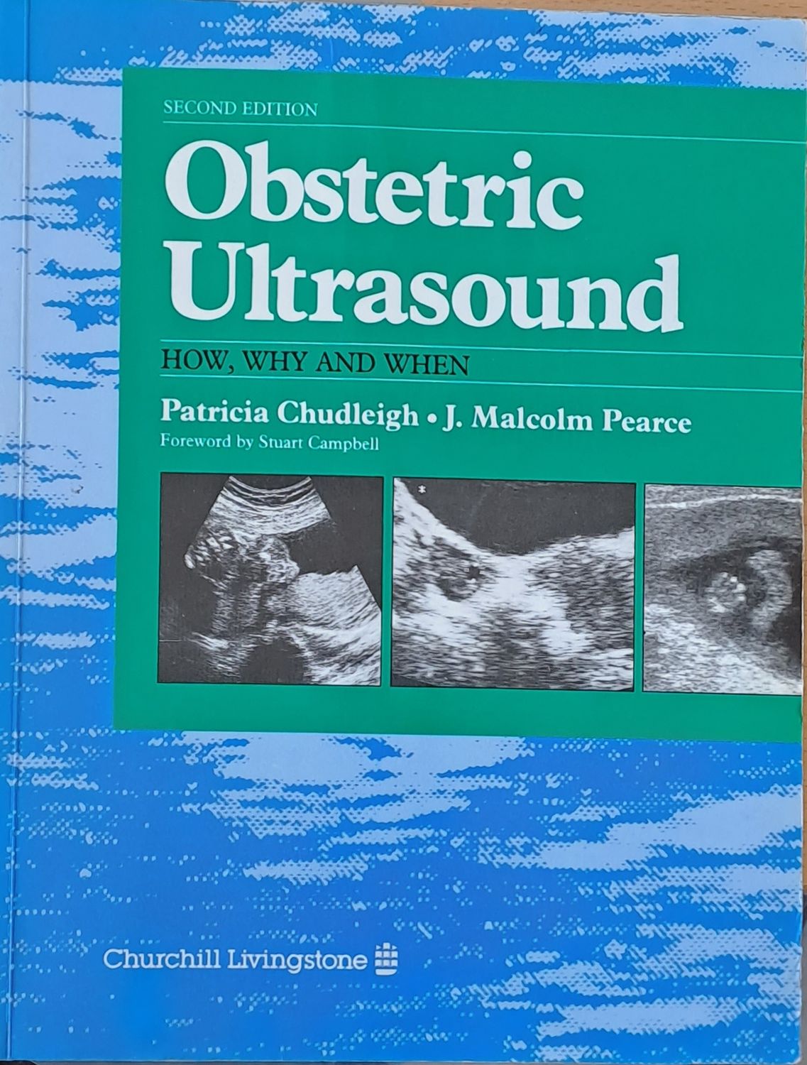 Obstetric Ultrasound
