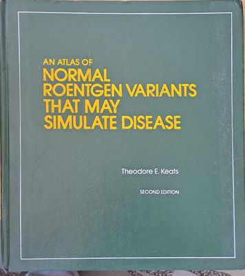 An Atlas of Normal Roentgen Variants that may simulate Disease, second edition