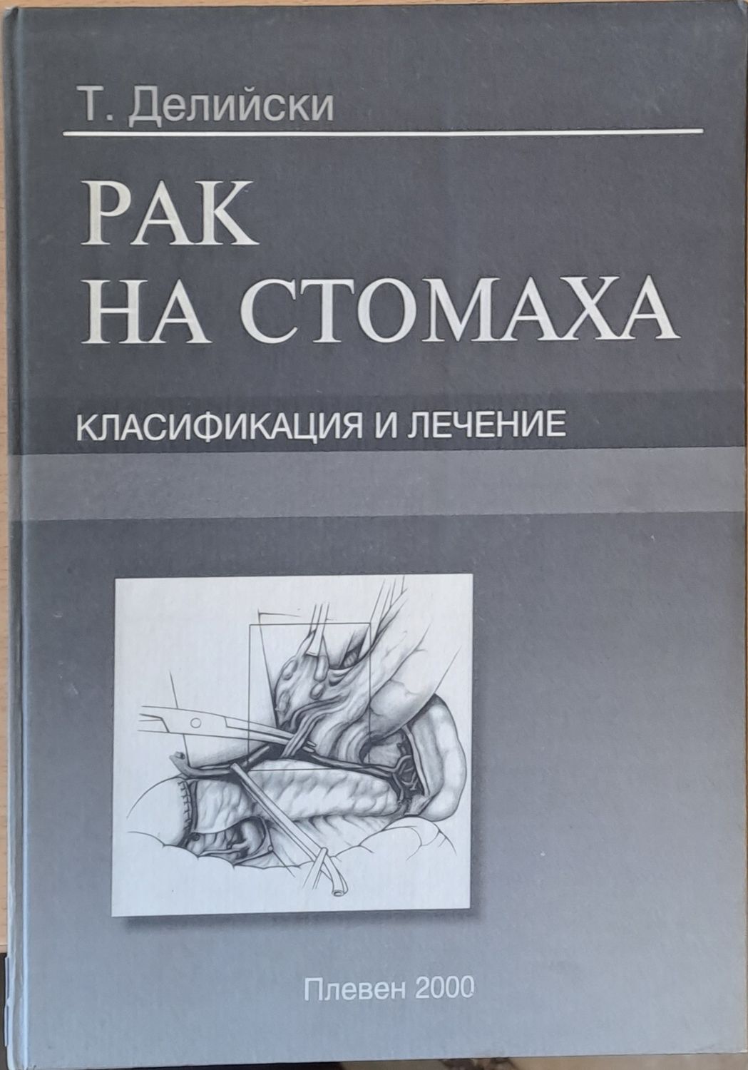 Рак на стомаха, Класификация и лечение