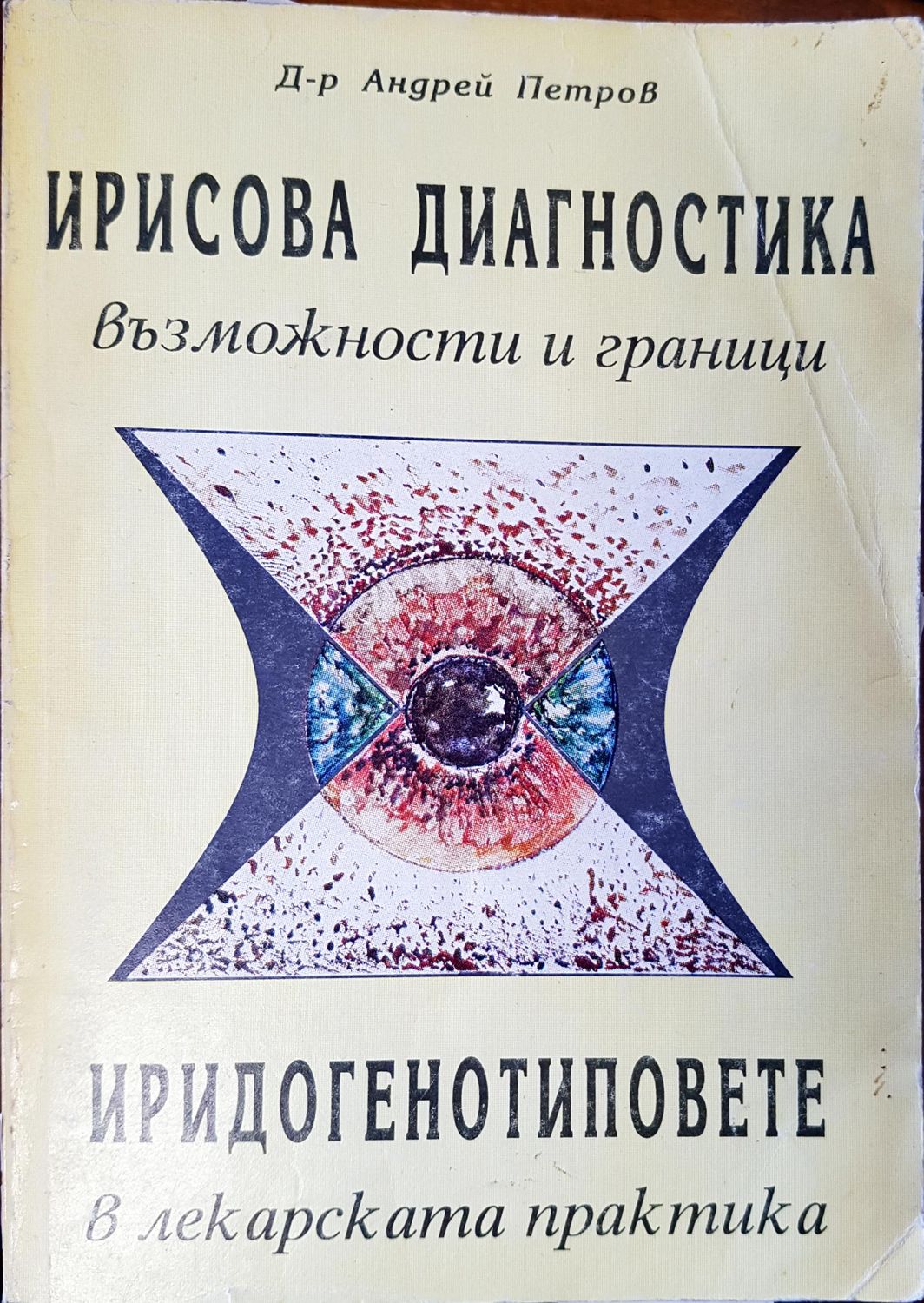 Ирисова диагностика