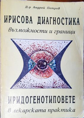 Ирисова диагностика