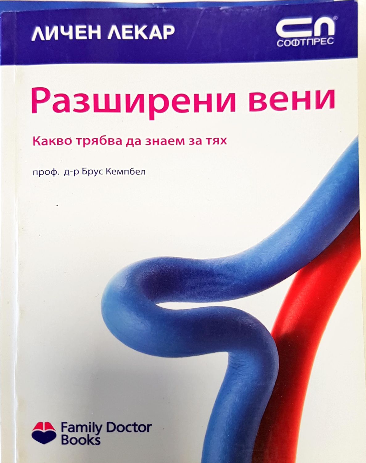 Разширени вени