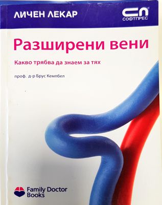Разширени вени
