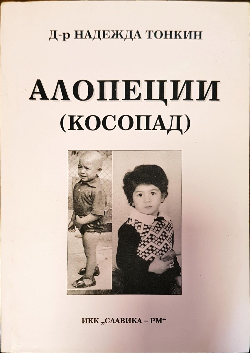 Алопеции косопат