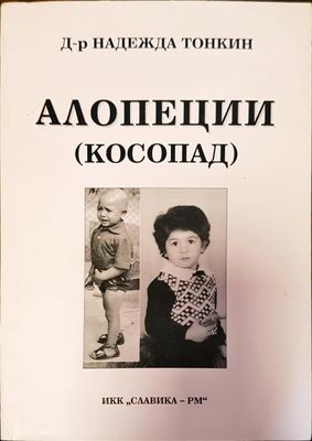 Алопеции косопат