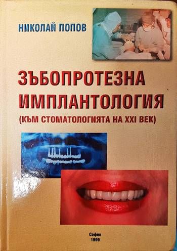 Зъбопротезна имплантология