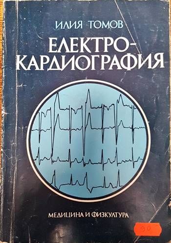 Електрокардиография