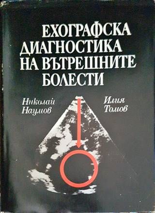 Ехографска диагностика на вътрешните болести