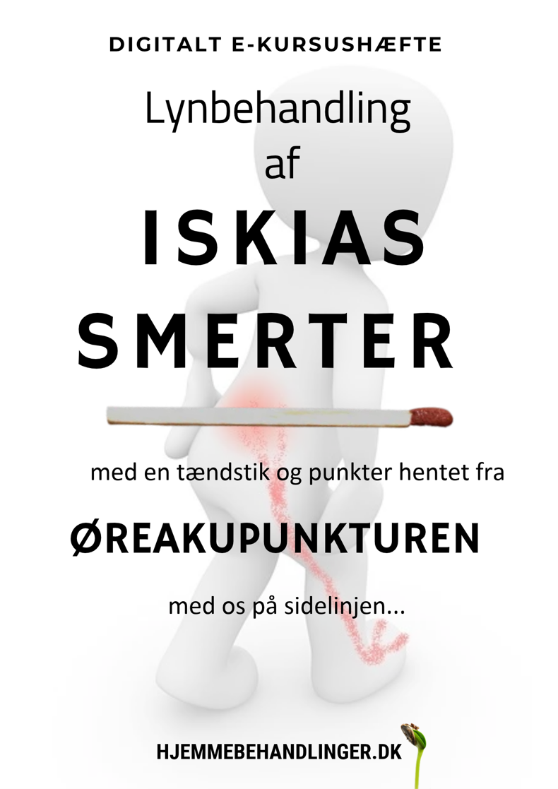 Lynafbalancering  af iskiassmerter  med en tændstik og punktet hentet fra øreakupunkturen