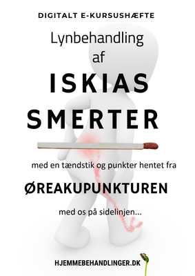Lynafbalancering  af iskiassmerter  med en tændstik og punktet hentet fra øreakupunkturen