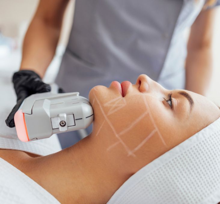 HIFU FACIAL