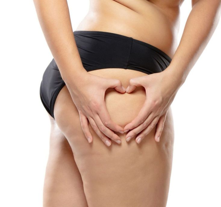 REDUCTIVO - CELULITIS DE PIERNAS