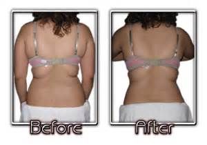 60min Elite Body Slimming - Sides