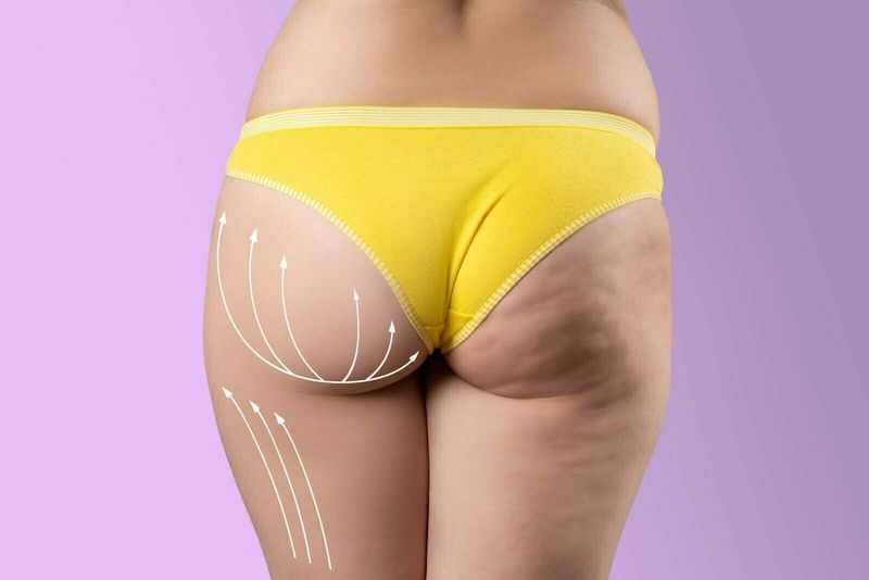 60min Body Slimming - Back of Leg & Glute