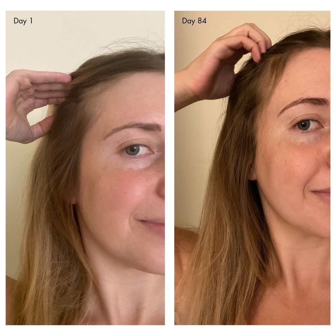 holi (growth) 84 advanced leave-in growth scalp treatment