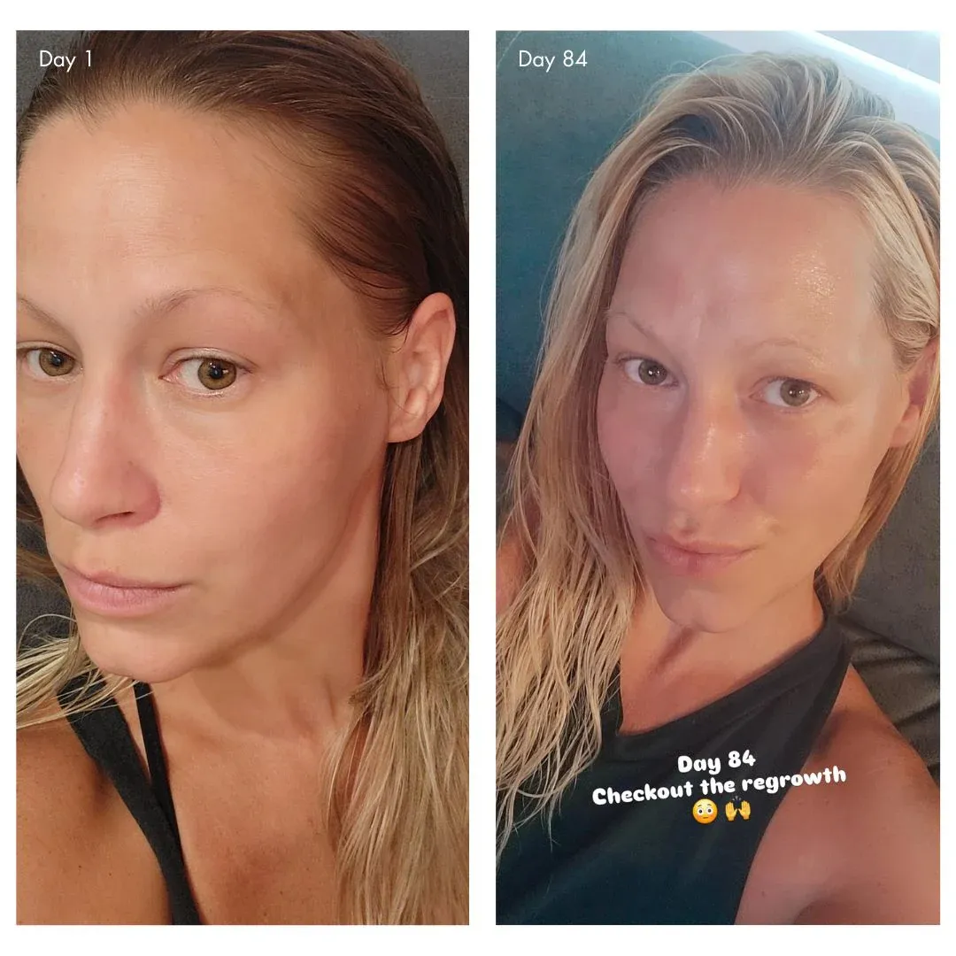 holi (growth) 84 advanced leave-in growth scalp treatment