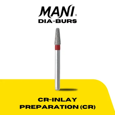CR inlay preparation