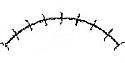16" x 6.5" Clamp Arch/25 p/box