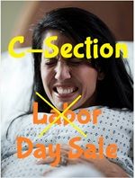 C-Section Sale
