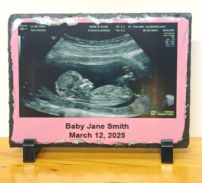 Personalized Sonogram/Ultrasound Slates