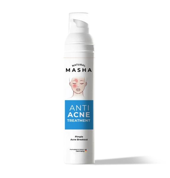 MASHA ANTI ACNE TREATMENT