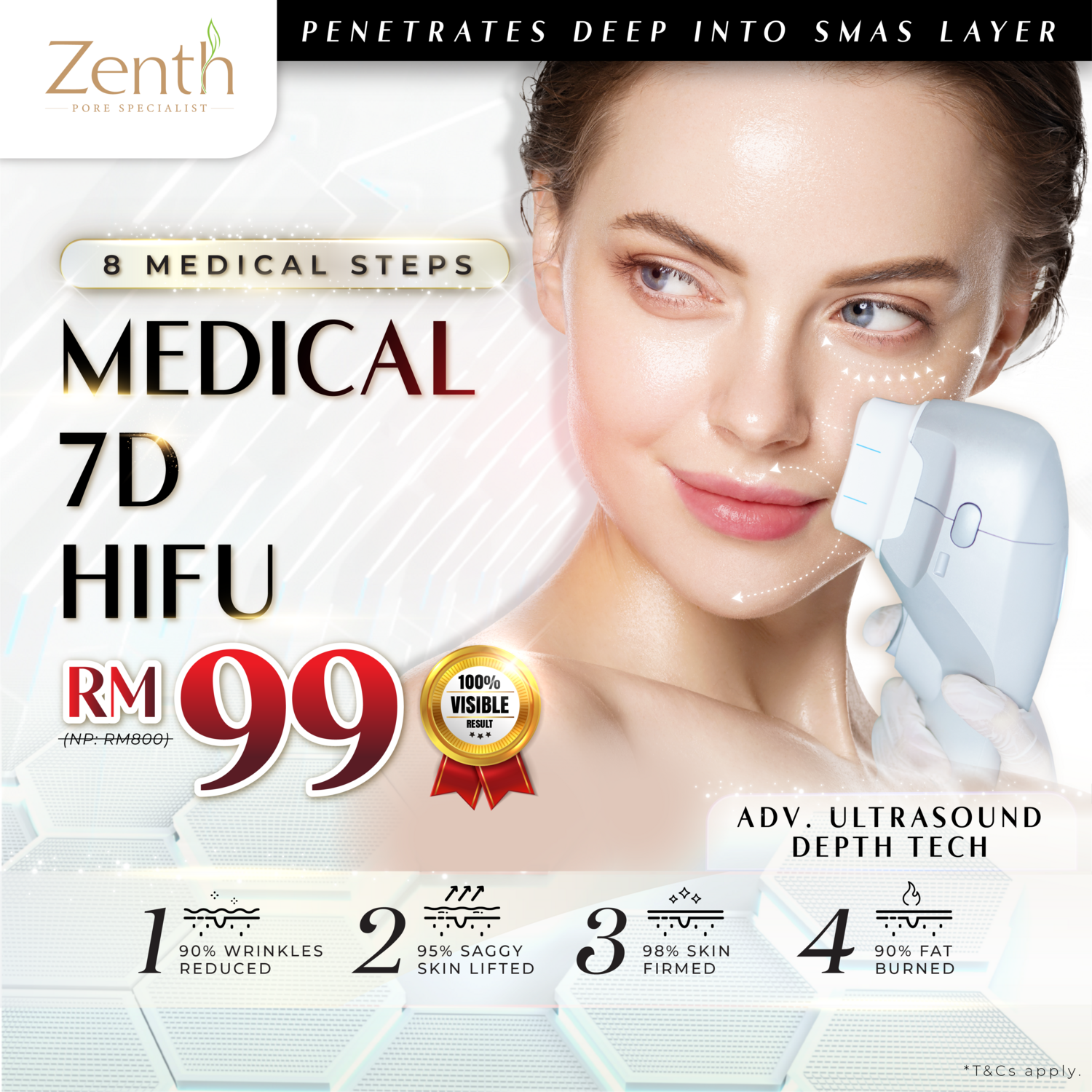 7D-HIFU (Skin Tightening Treatment)
