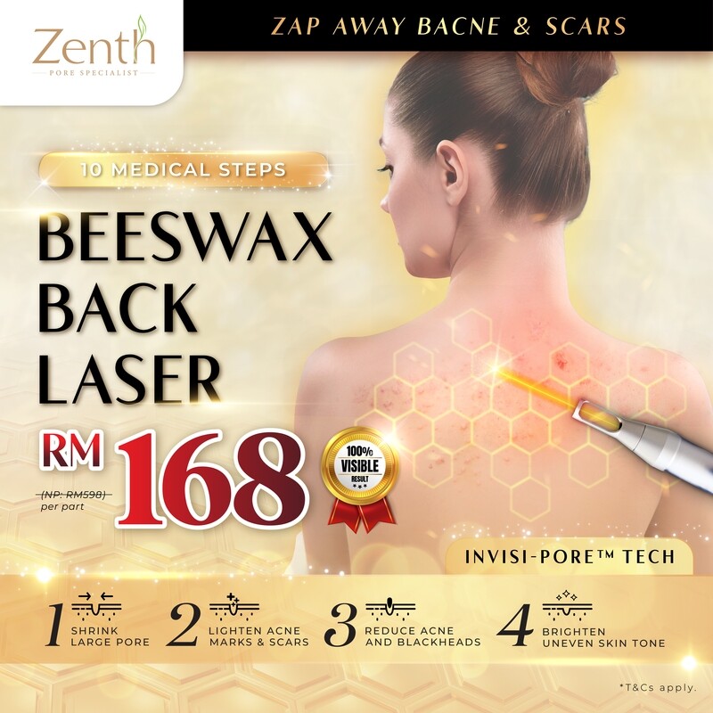 Beeswax Back Laser (Back Acne Treatment)
