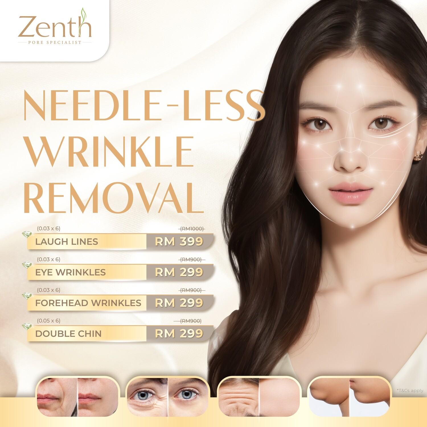 NEEDLE-LESS Wrinkle Removal Treatment（无针式·祛纹护理）