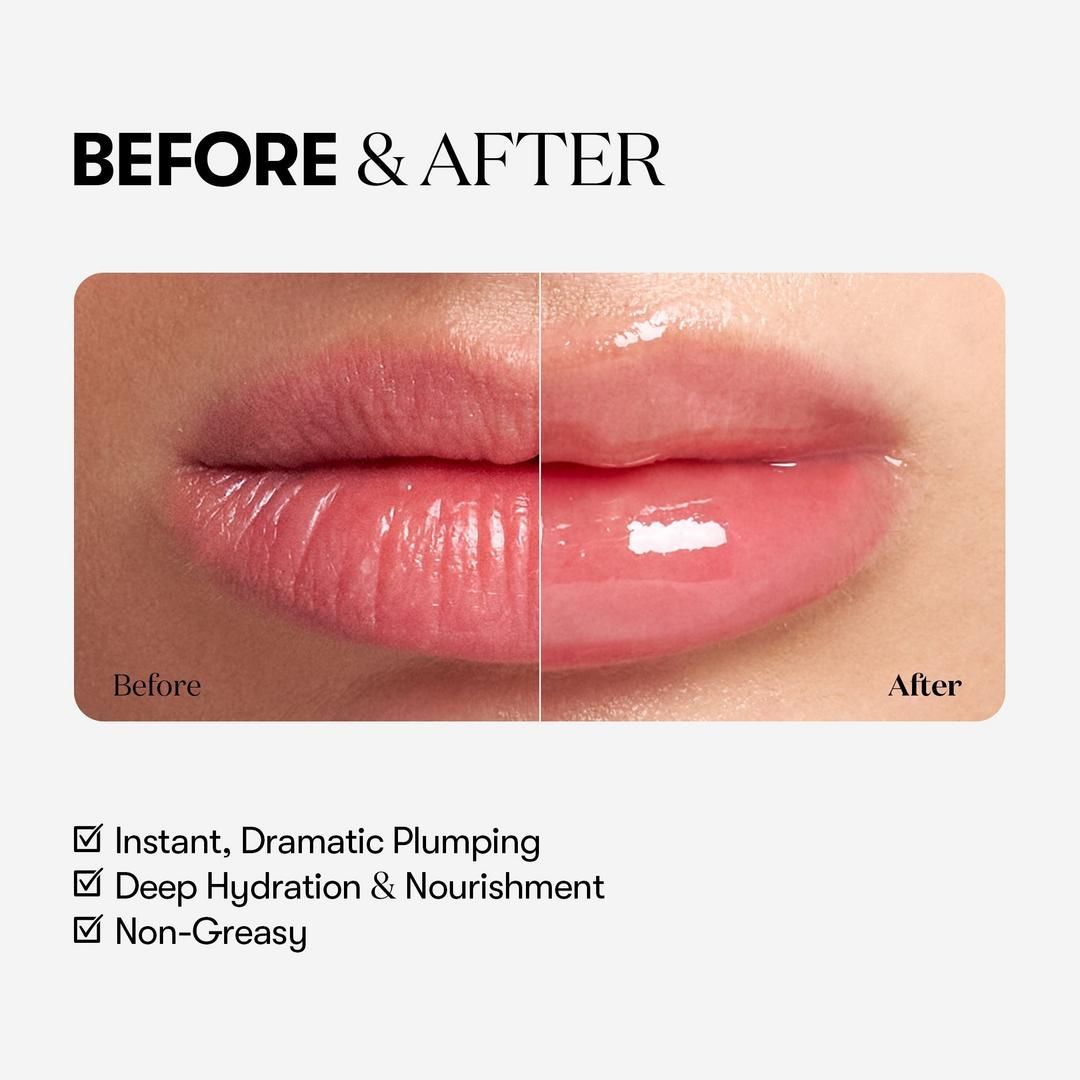 [VT] REEDLE SHOT LIP PLUMPER, Strength: EXPERT