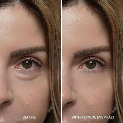 [Dr. Melaxin] EYEPHALT Retinol Eyebag Cream