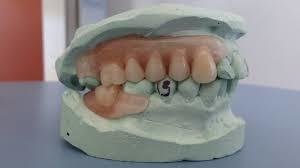 Protesis Flexible (hasta12 dientes)