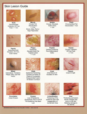 Skin Lesions Quick Reference Guides