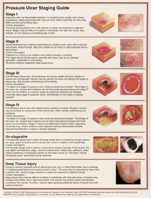 Pressure Ulcers Quick Reference Guide