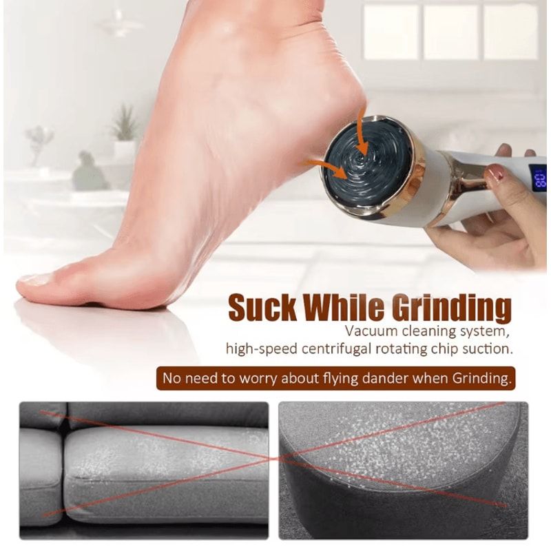 Electric Pedicure Callus Remover Professional Foot Grinder for Smooth Skin