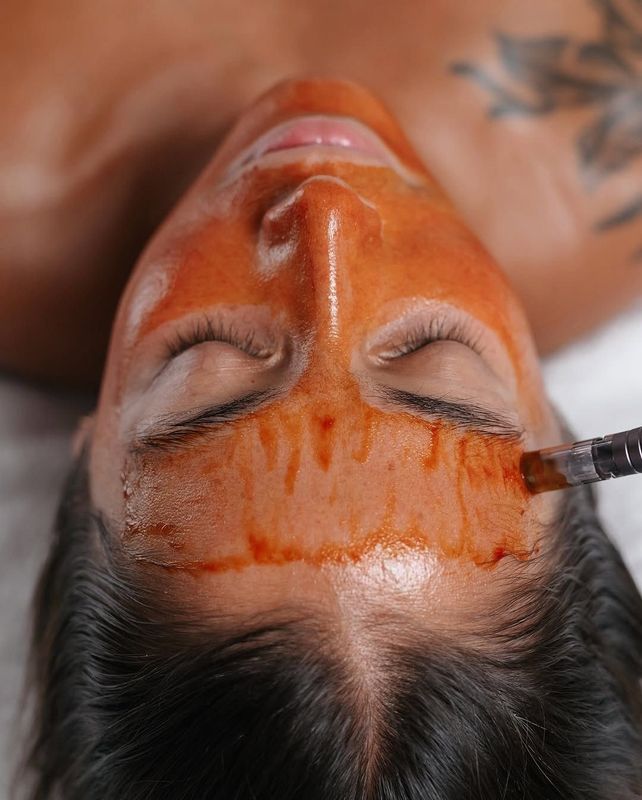 TRATTAMENTO VISO RX50