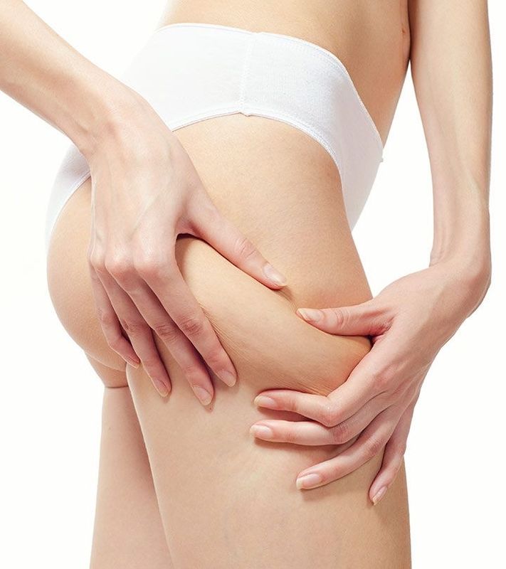 ENDERMOLOGIE ANTI-CELLULITE