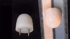 12V Small Pin-I Ceiling Globe CK842