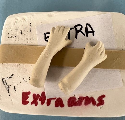 Extra Arms Mold for Children extraarms