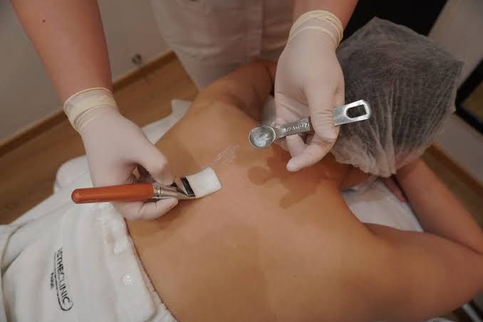 ​Body Blemish Treatment