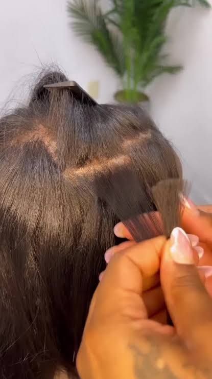 Microfusion (with HD/UV Light)