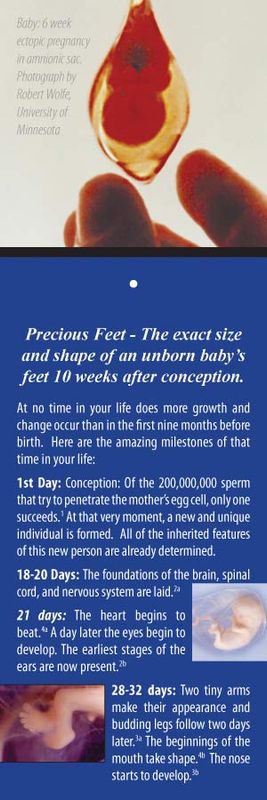 Pink Precious Feet Pin