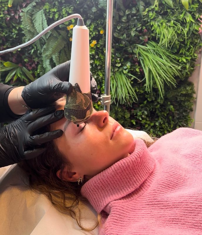 Plasma froid / plasma froid Russe 2 jours