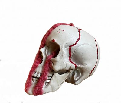 Bloody Head