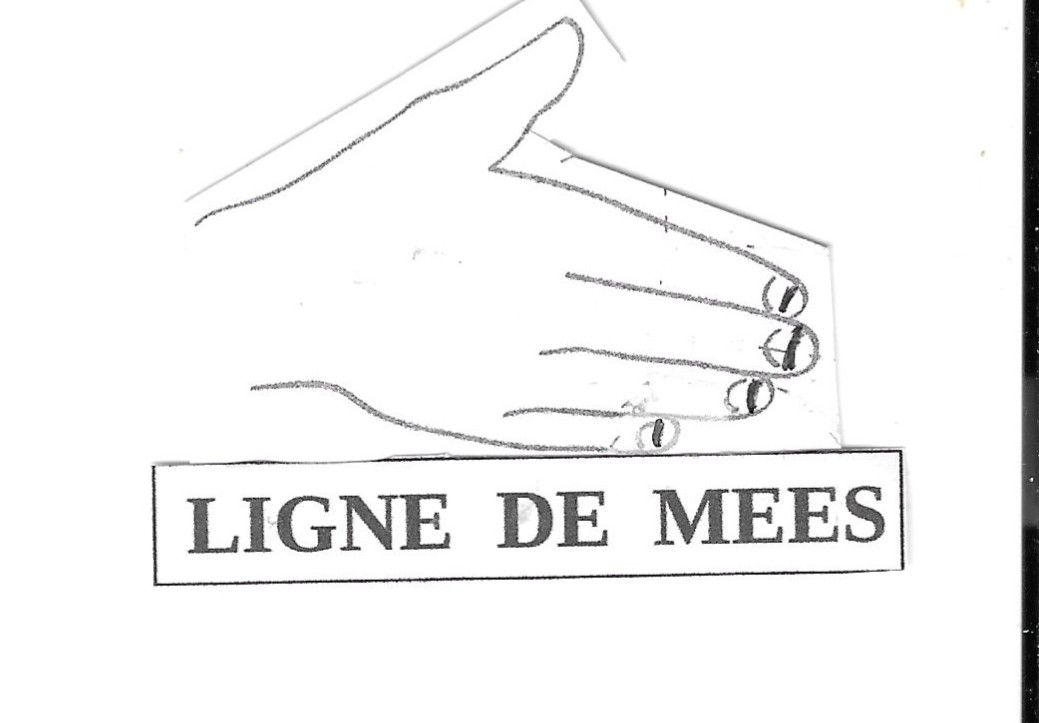 Ars. V | Degré d'oxydation | Voie Phosphate |Toxicité | Os