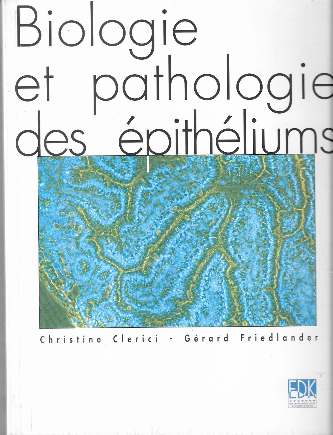 Chin-s | China sulfuricum | Canaux Chlorure | Epithèlium | Sensibilité au pH acide | Famille