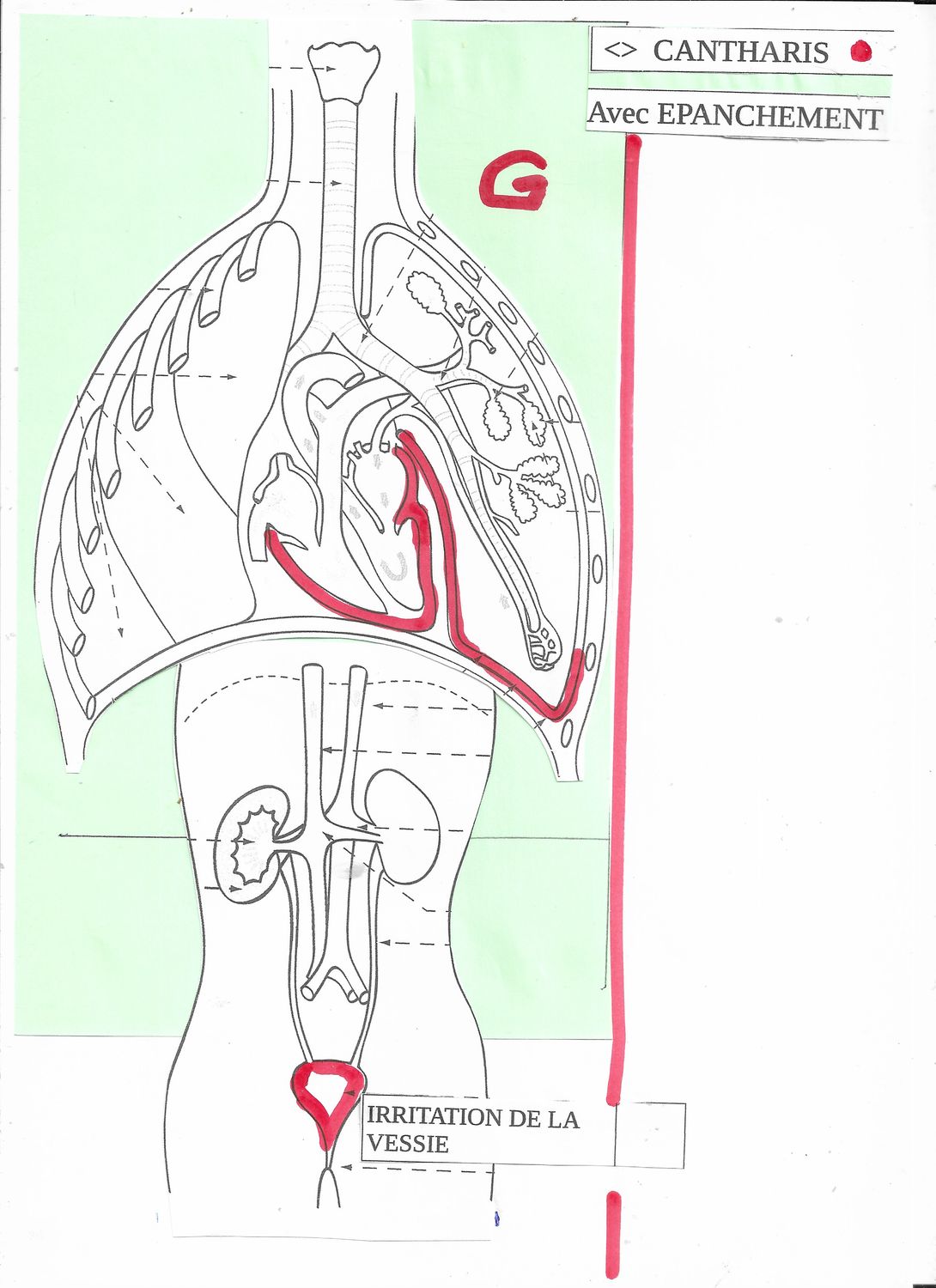 Canth. | Cantharis | Dyspnée | Epanchement