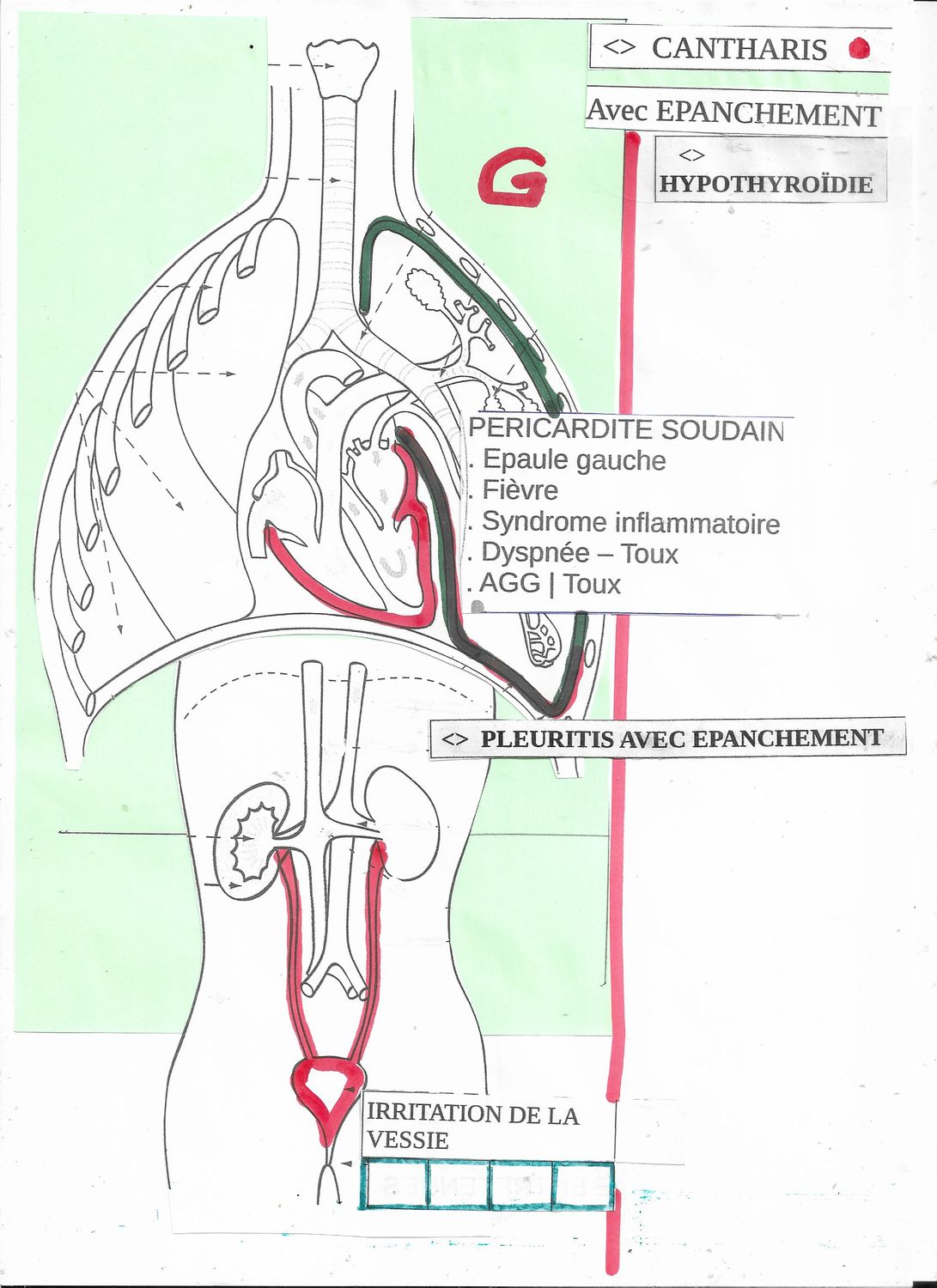 Canth. | Cantharis | Dyspnée | Epanchement | Hypothyroïdie