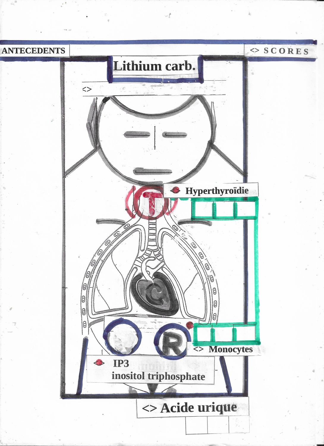 IP3 |  Lithium carb. | synoptique