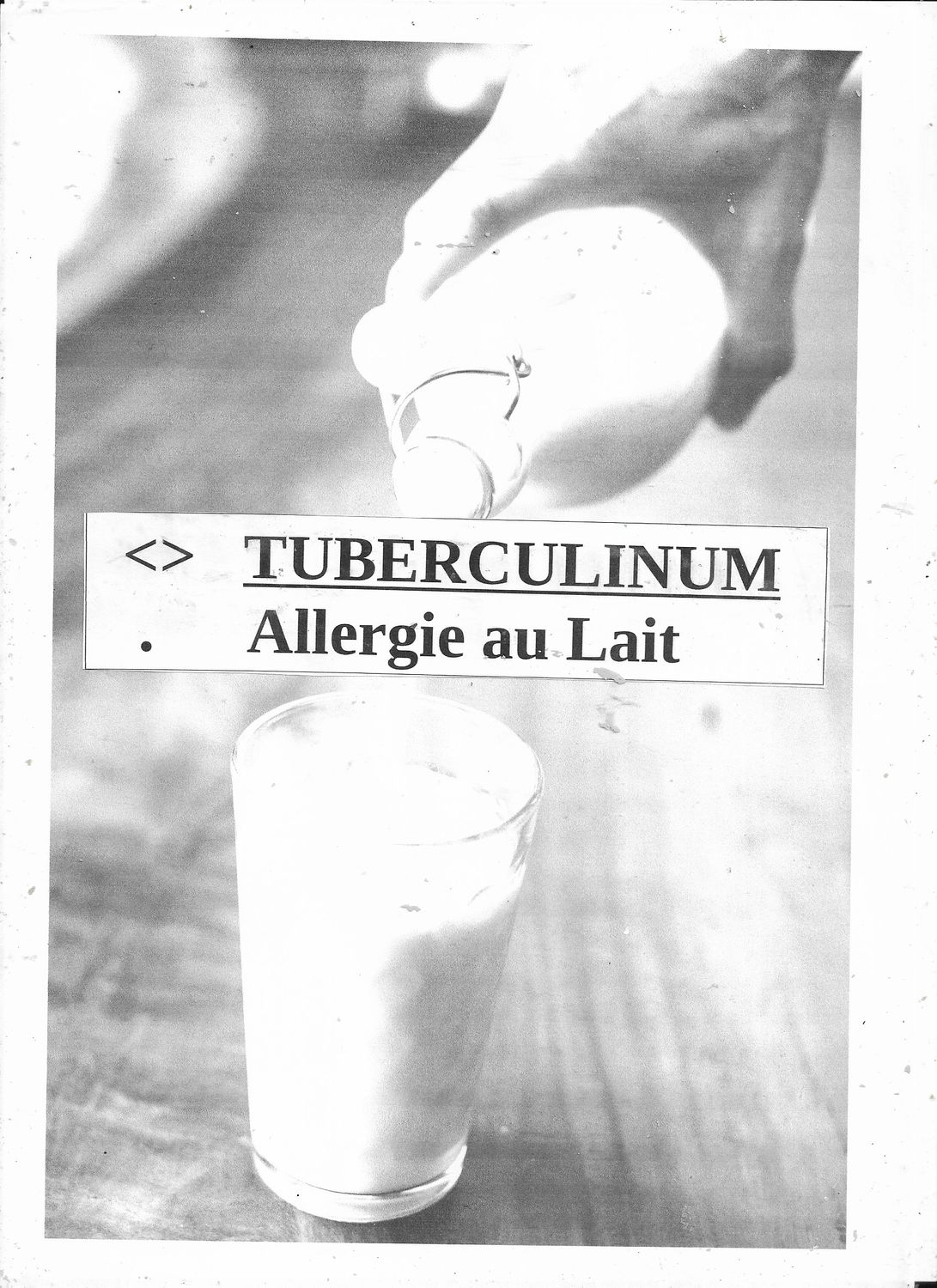 Allergie au lait