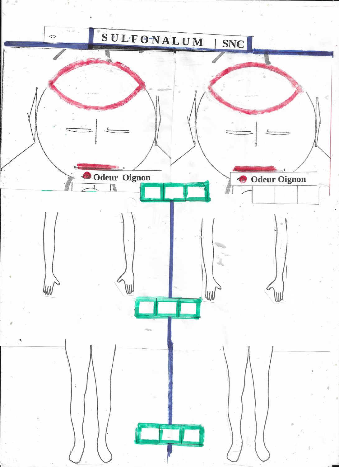 Sulfonalum - synoptique + CNS Clinical symptoms ***
